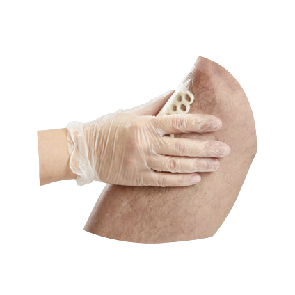 Opsite_postop_visible_kärgplaaster